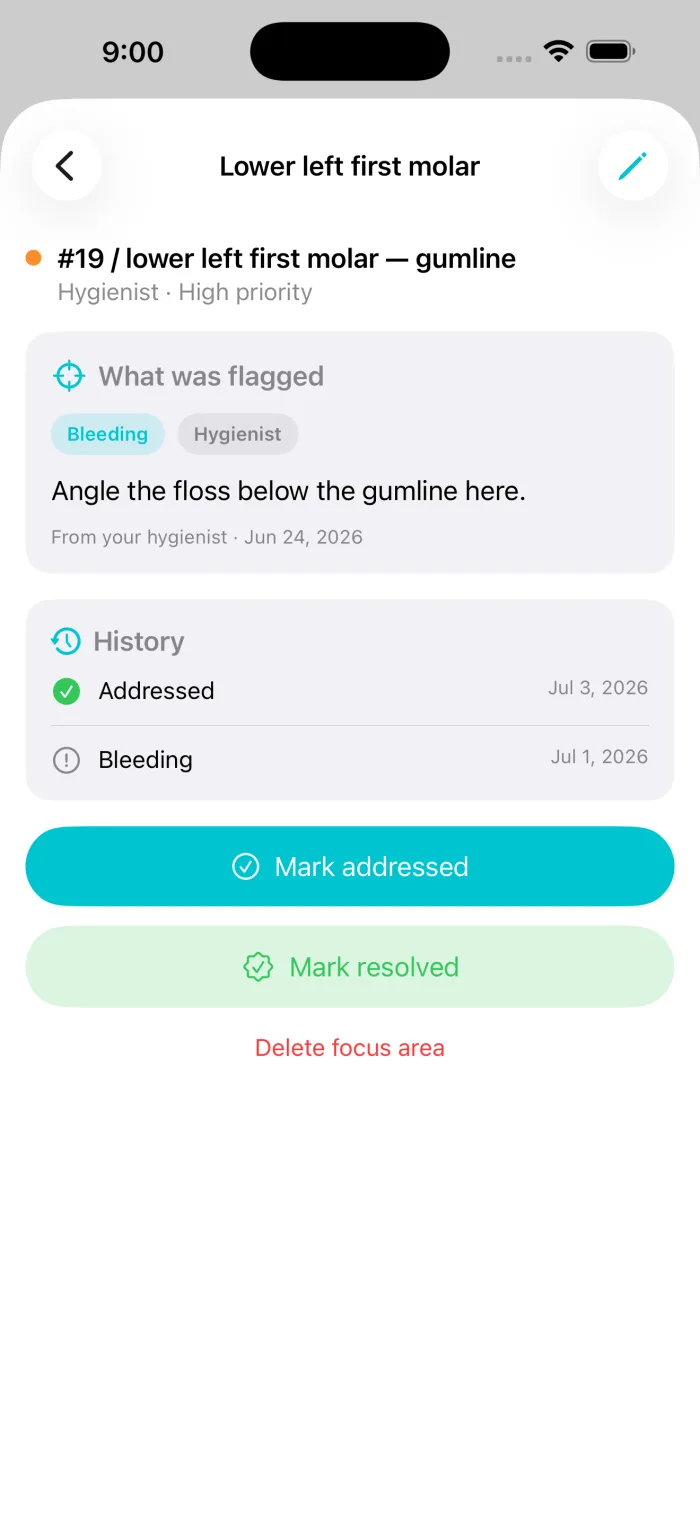 Gumline focus-area detail for a lower-left molar: what was flagged, the care instruction to angle the floss below the gumline, and a dated history of when it was addressed.