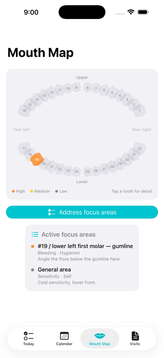 Gumline Mouth Map: an odontogram of the upper and lower teeth, with dentist-flagged teeth color-coded by priority and a list of active focus areas below.